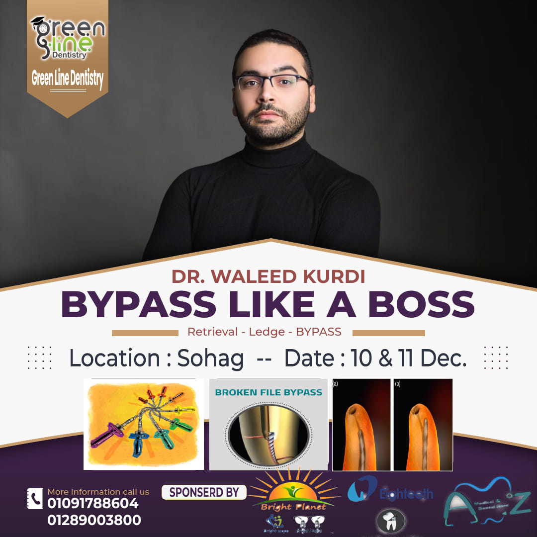 BYPASS LIKE A BOSS